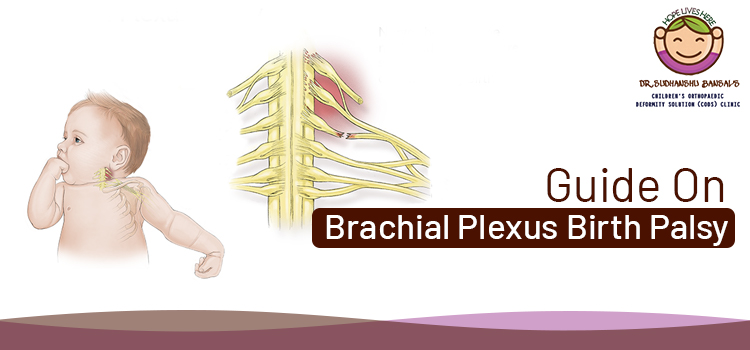 Guide On Brachial Plexus Birth Palsy