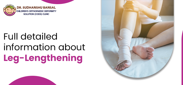 Benefits and risk factors of getting a limb-lengthening surgery